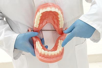 Partial Denture | Nashville TN
