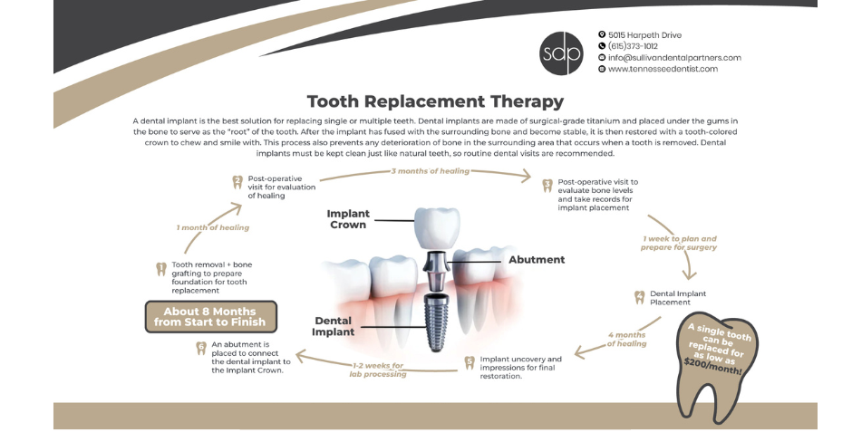 Tooth Replacement Therapy in Nashville, TN Information