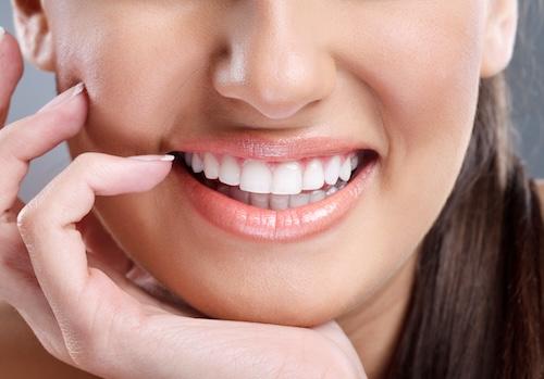 Woman smiling with porcelain veneers, nashville tn