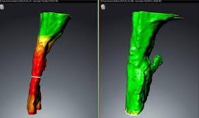 sleep apnea | brentwood tn dentist