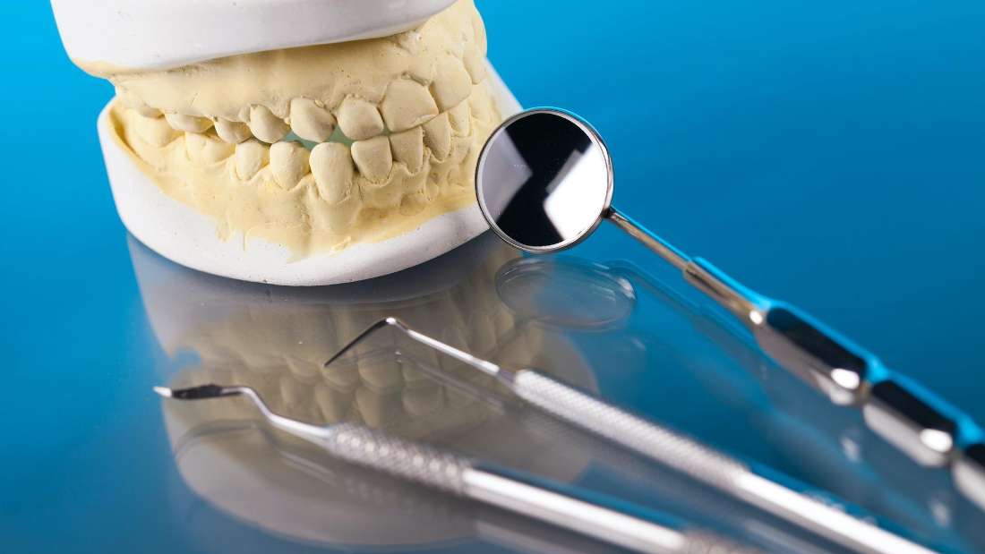 A dental mold and dental tools | dentist Brentwood TN
