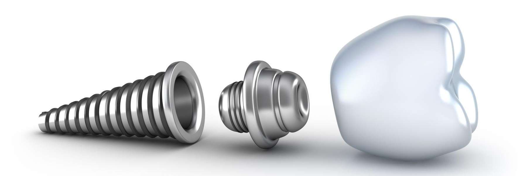 An image of a dental implant purposely broken into three pieces, nashville tn