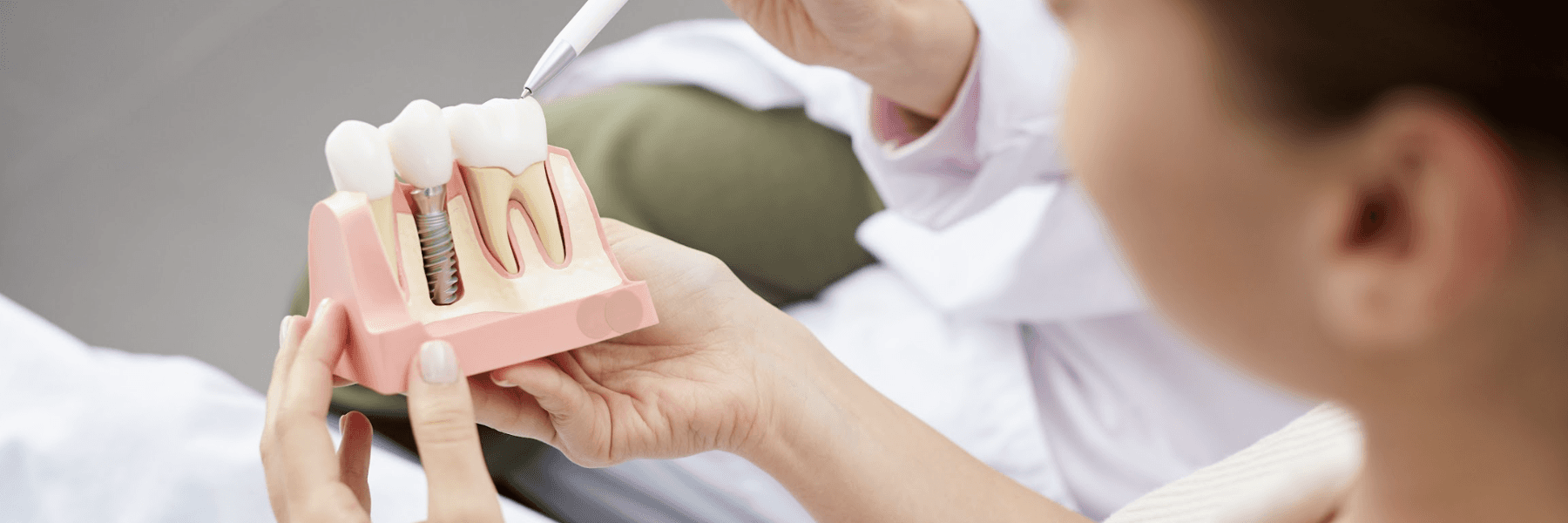 Patient looking at mold of dental implants, nashville tn