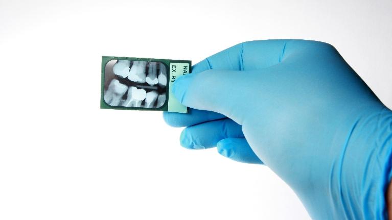 dentist holding x-ray | brentwood tn dentist