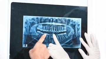 dentist looking at an x-ray in brentwood tn