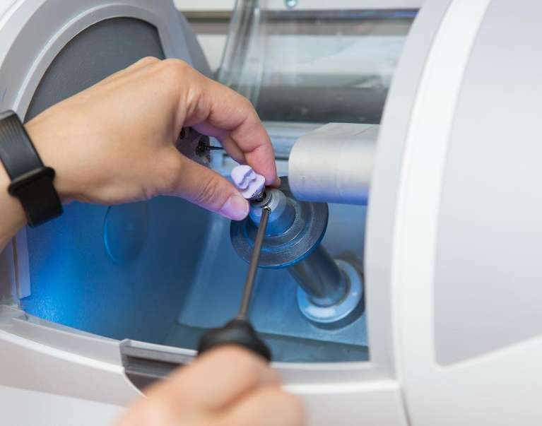 CEREC crown at sullivan dental partners, nashville tn