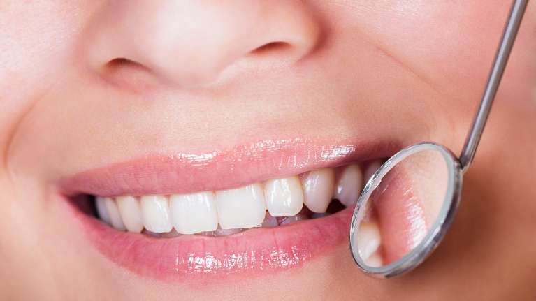 Dental mirror right next to womans mouth, brentwood tn