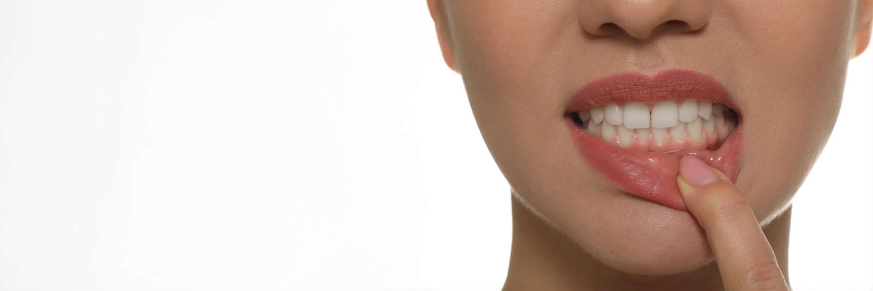 Soft Tissue Grafting | Dentist