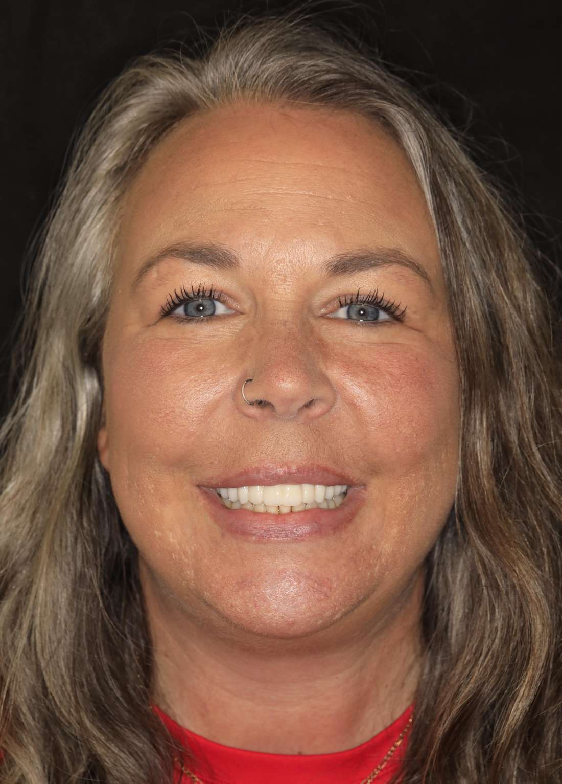 Middle aged woman smiling after all-on-x implant dentures, nashville tn