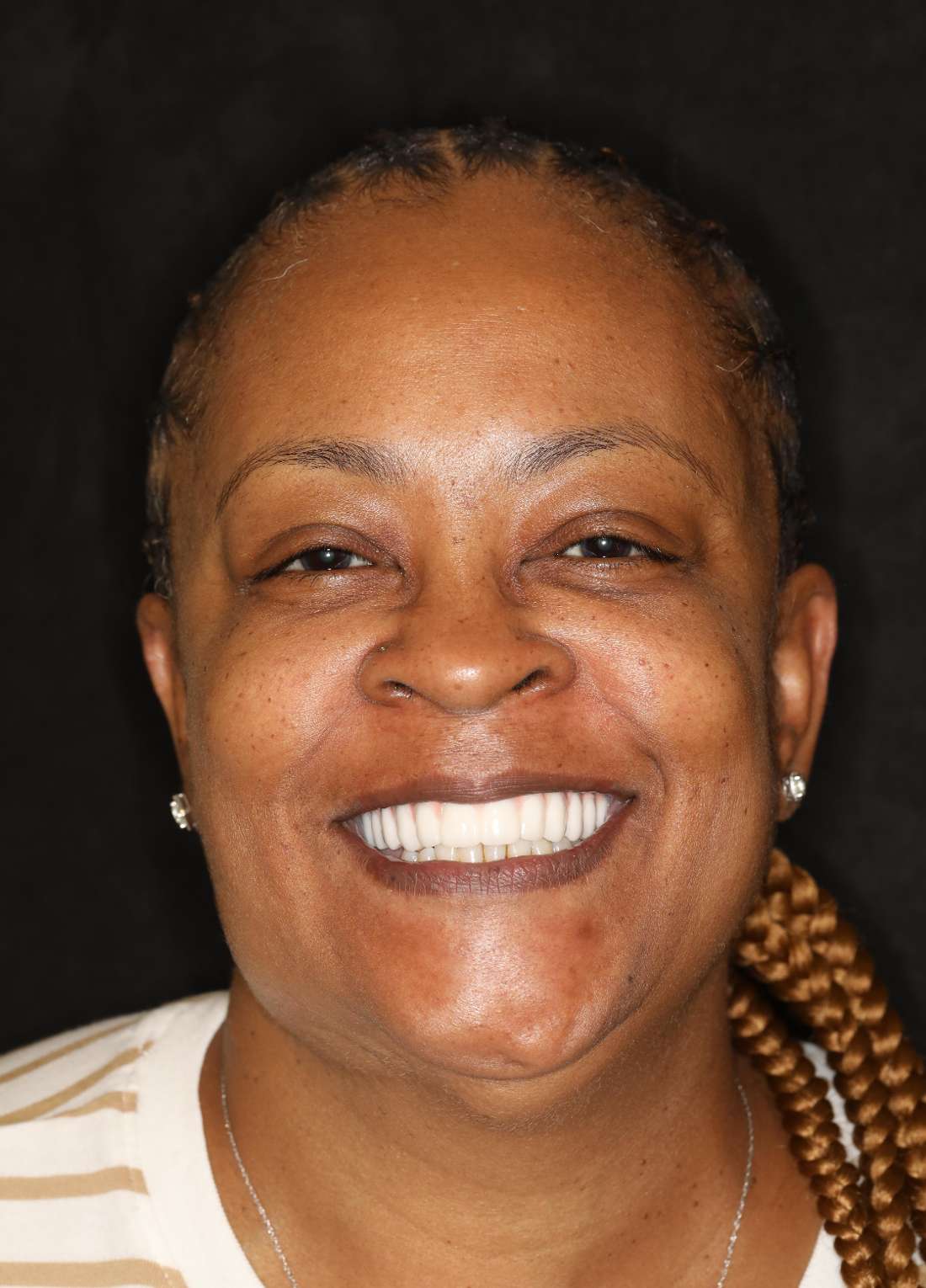 Woman smiling after all-on-x implant dentures, nashville tn