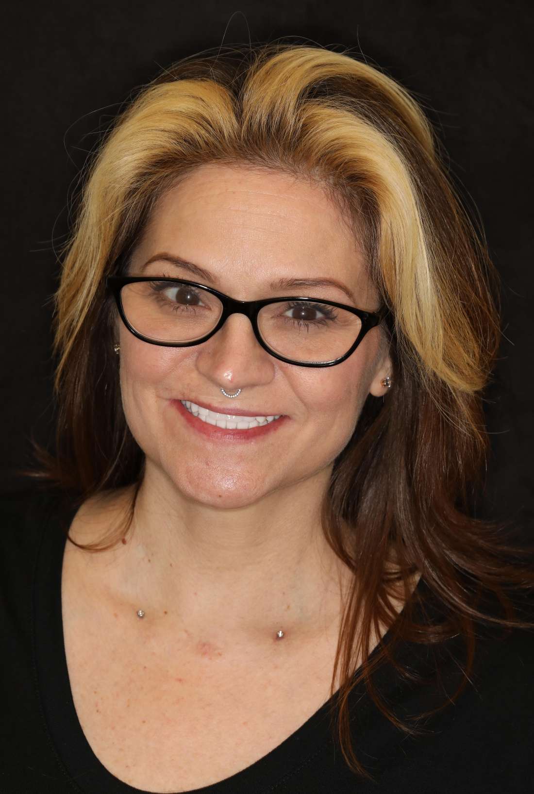 After of full mouth smile makeover, nashville tn