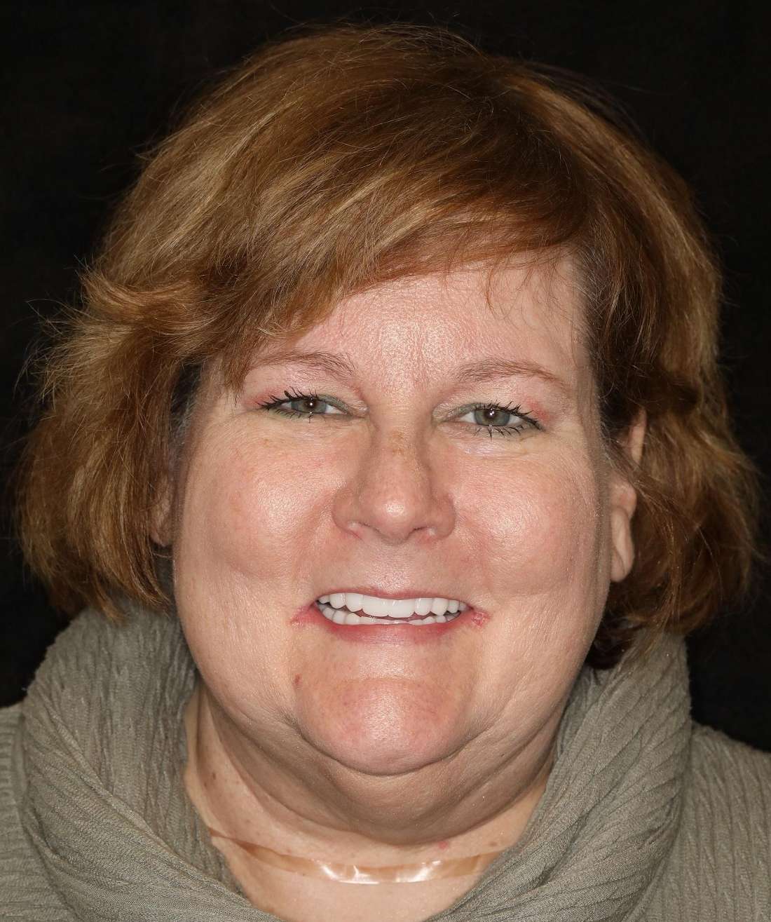 Full view of woman after implant dentures, nashville tn