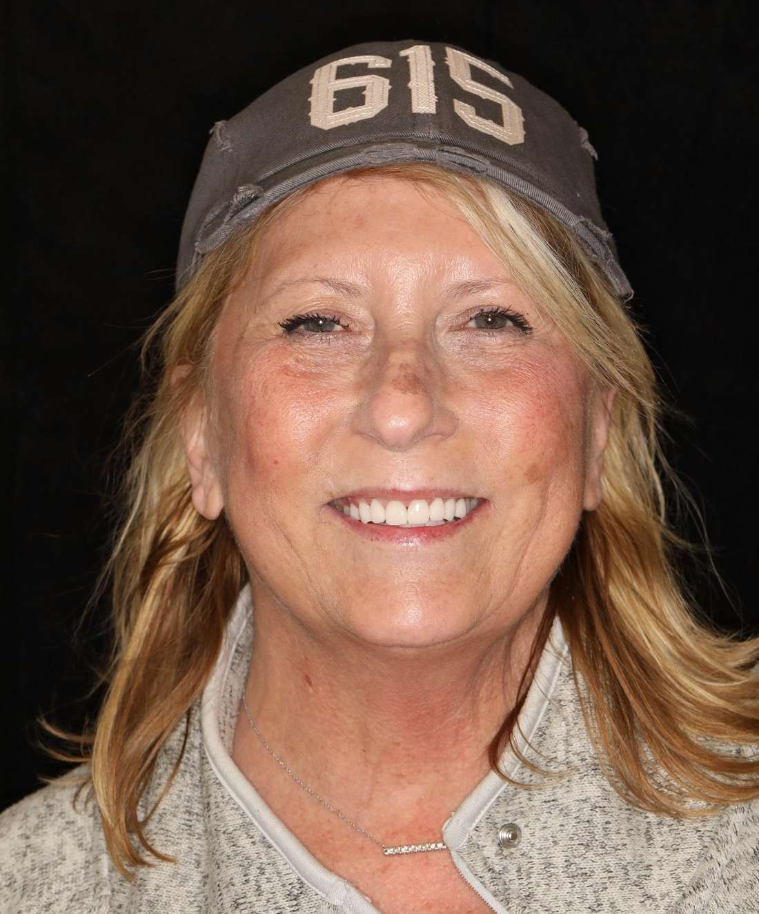 Potrait layout of blonde woman after cosmetic crowns, brentwood tn