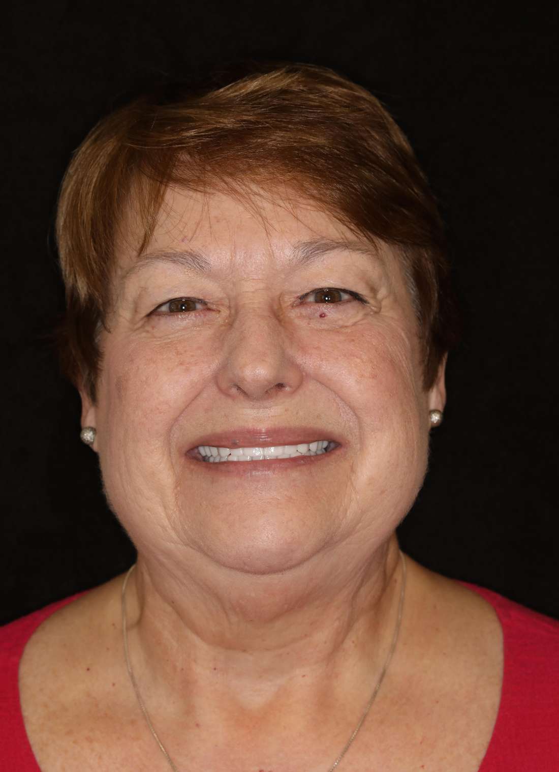 Older woman with brown hair after cosmetic crowns, brentwood tn