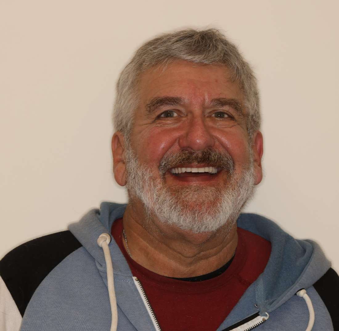 Dentures in Brentwood, TN- After Photo