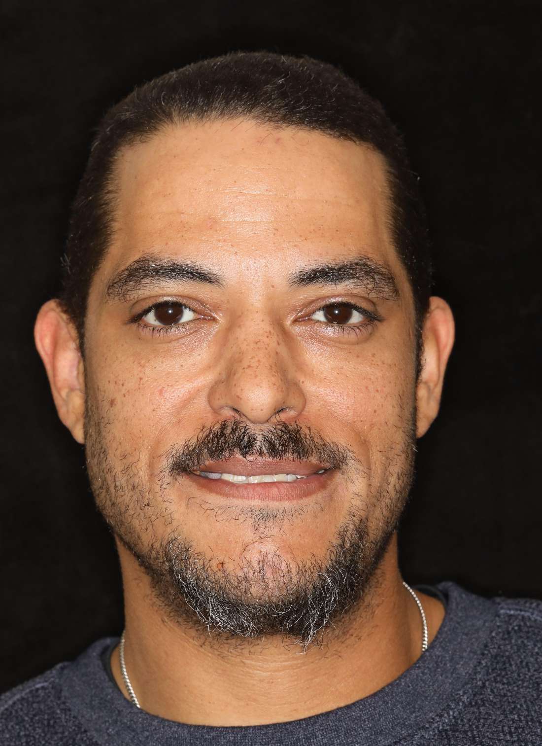 Man smiling before all-on-x implant dentures nashville tn