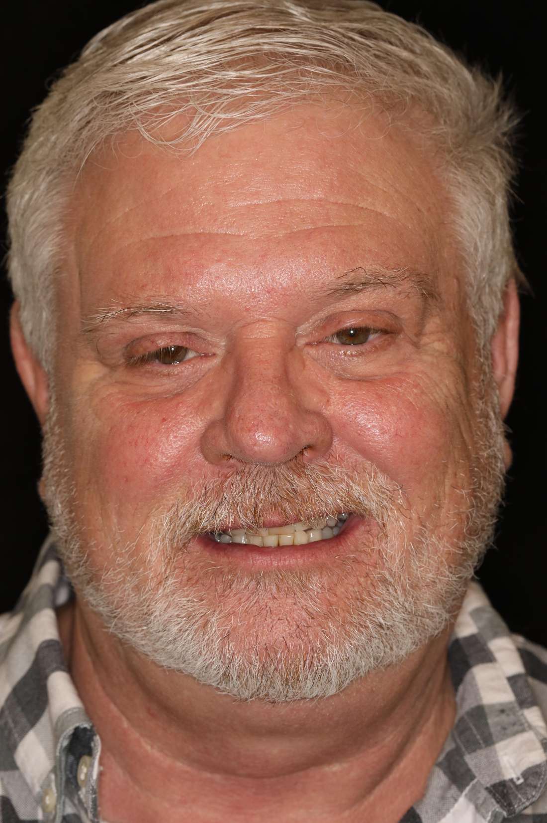 Older man smiling before all-on-x implant dentures, nashville tn
