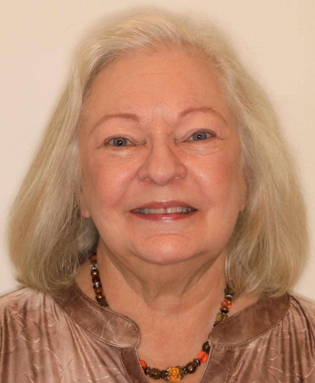 Older woman before CEREC cosmetic crowns, brentwood tn