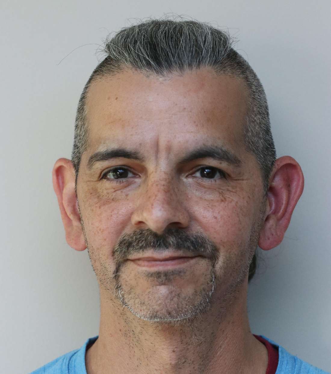 Nashville implant dentures- Before Photo