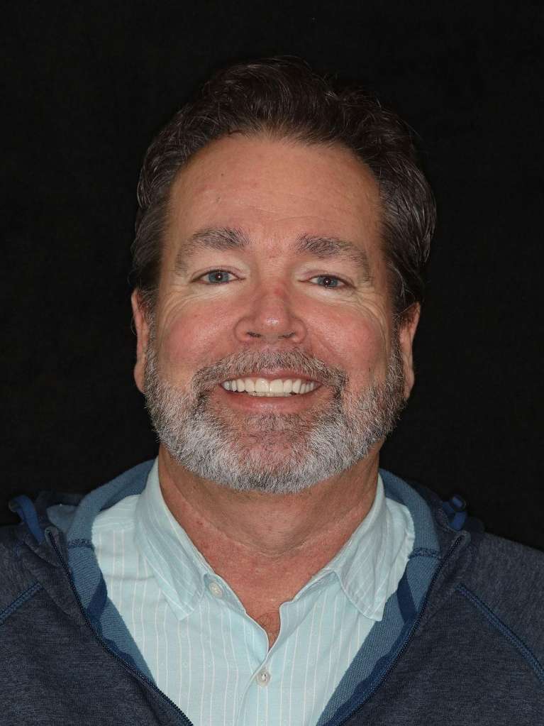 After photos of patient will a full mouth makeover from Sullivan Dental Partners in Brentwood, TN