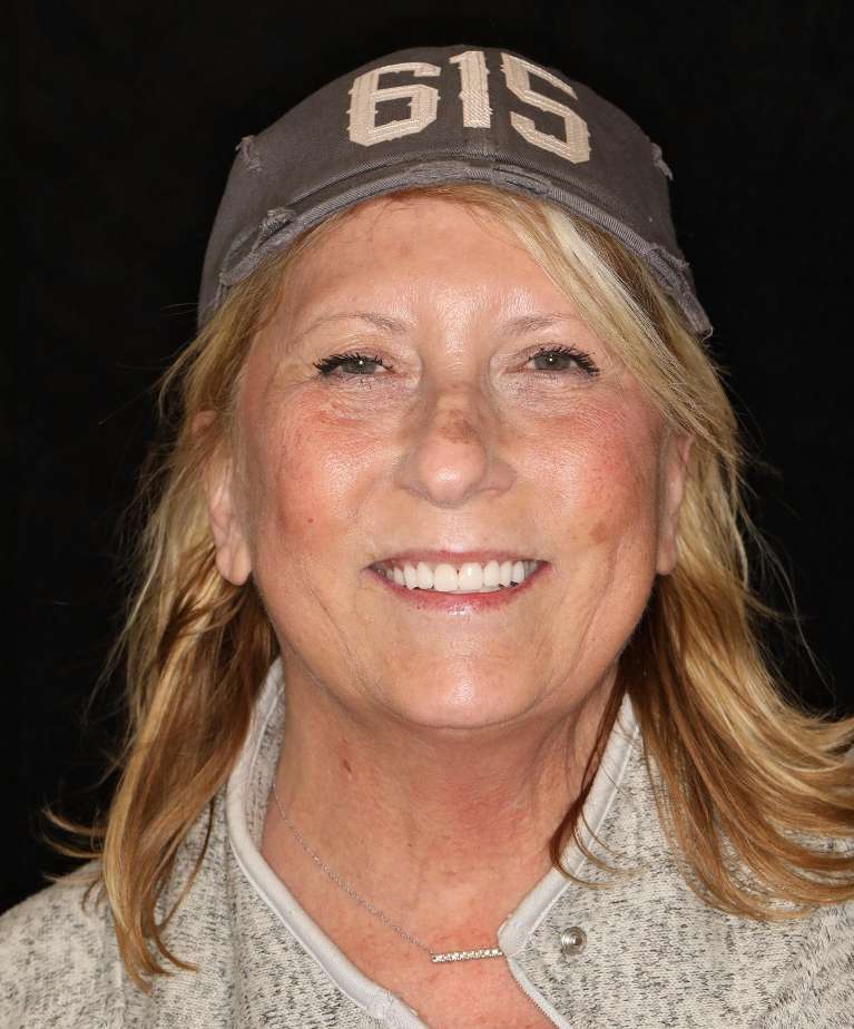 Potrait layout of blonde woman after cosmetic crowns, brentwood tn