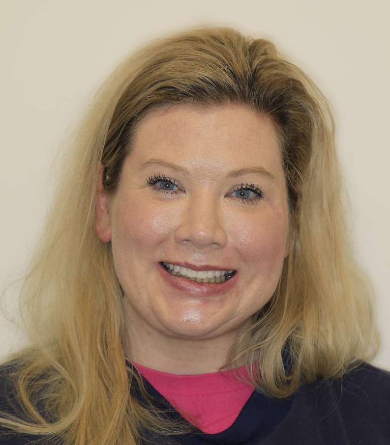 Brentwood Crowns- After Photo