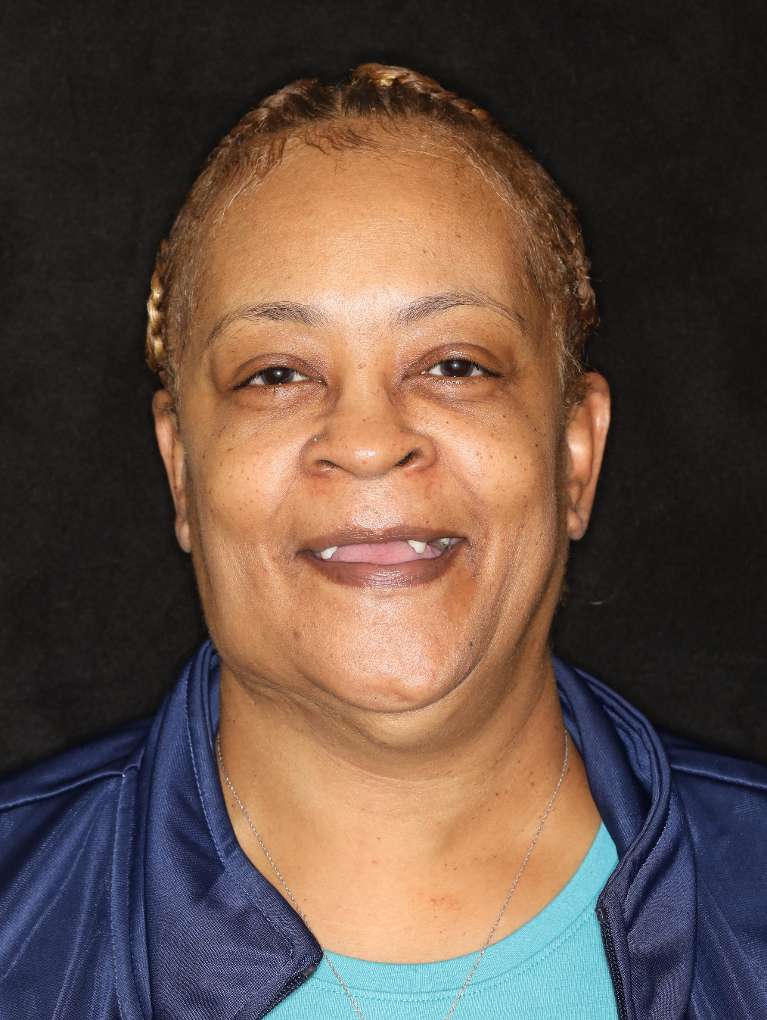 All-on-X-Implant-Dentures-Before-Image