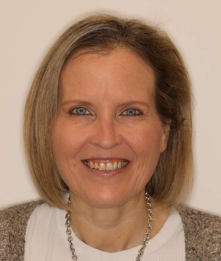 Woman smiling before cosmetic crowns, brentwood tn