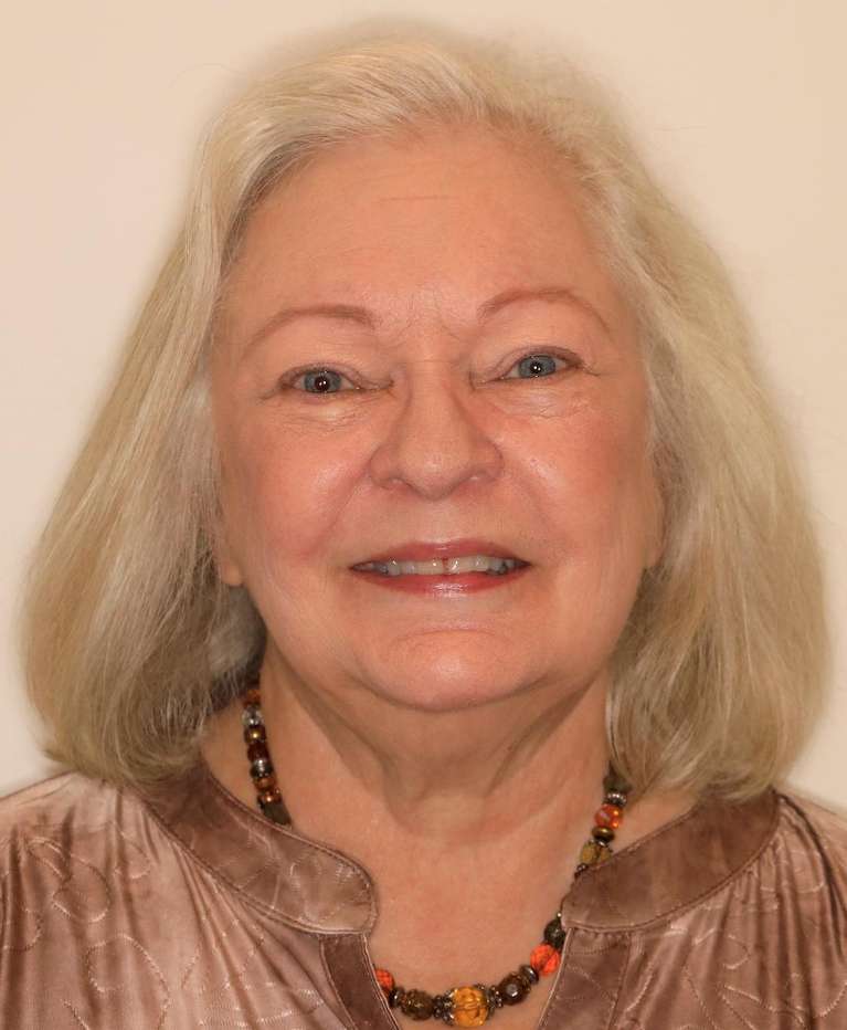 Cosmetic-Dentistry-Cosmetic-Crowns-CEREC-Before-Image