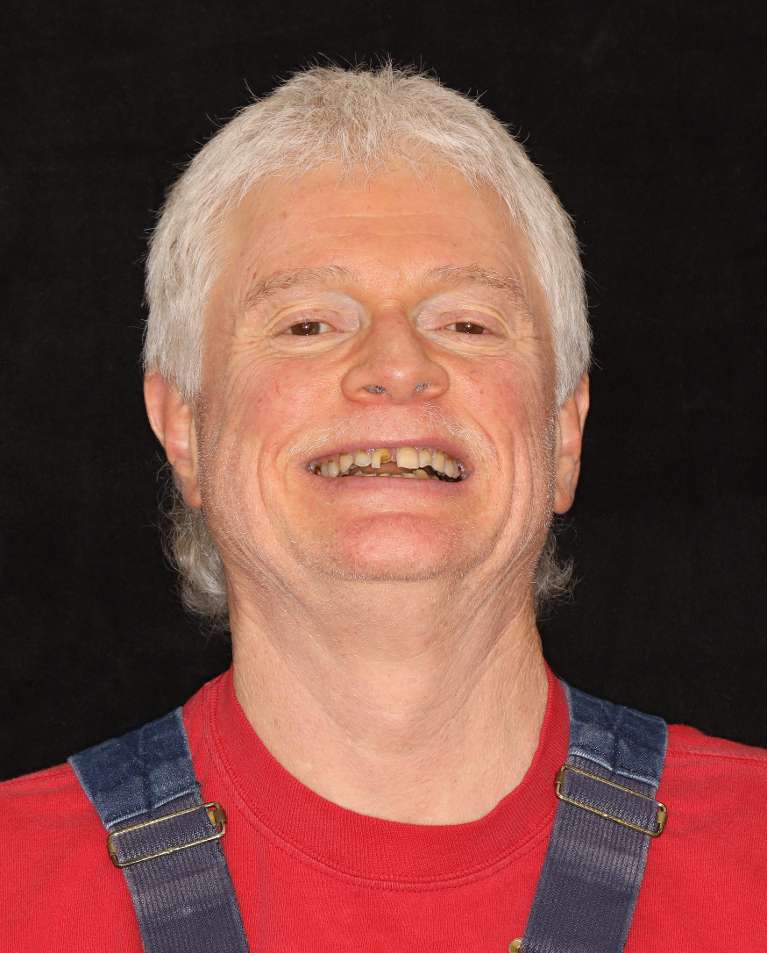 Smile-Makeover-Before-Image