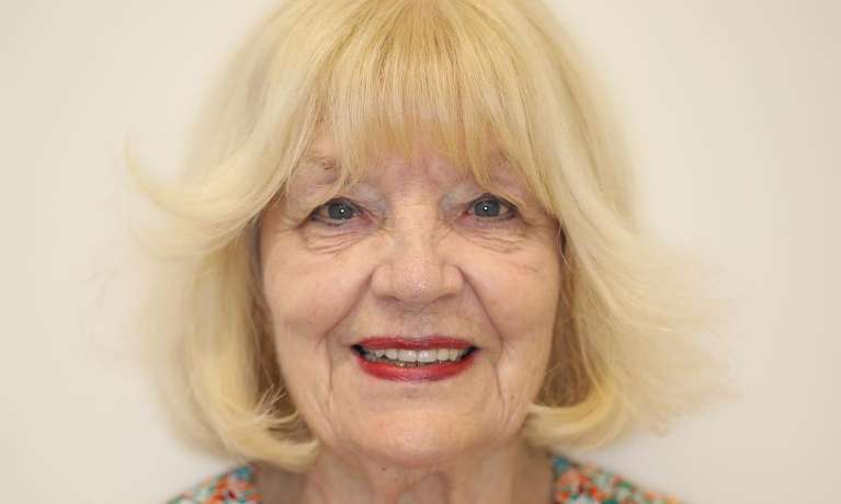 Full head view of elderly woman smiling before cosmetic crowns, brentwood tn