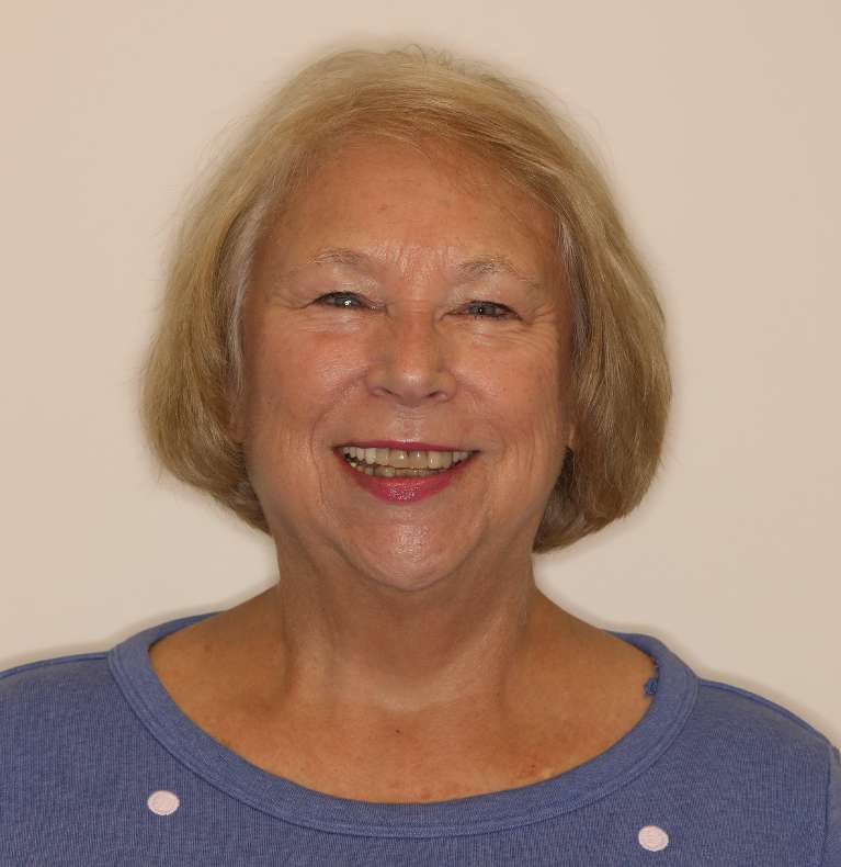 Smile Makeover in Brentwood, TN- Before Photo