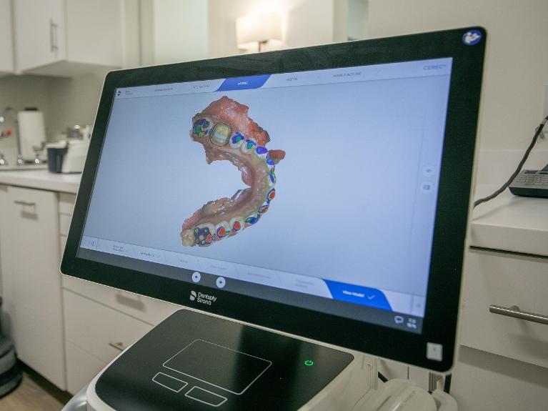 digital impressions Sullivan Dental Partners